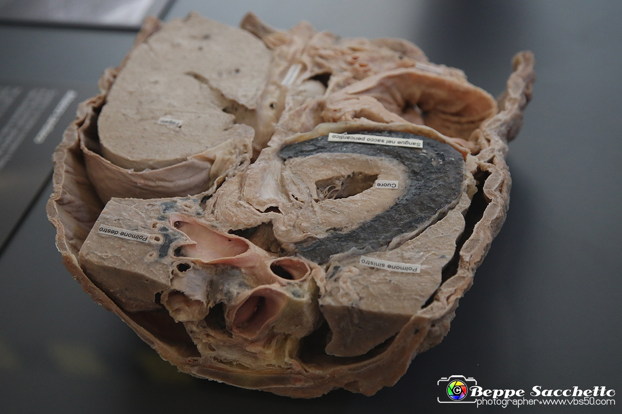 VBS_2875 - Cuore. Attacco cardiaco - Mostra Body Worlds.jpg